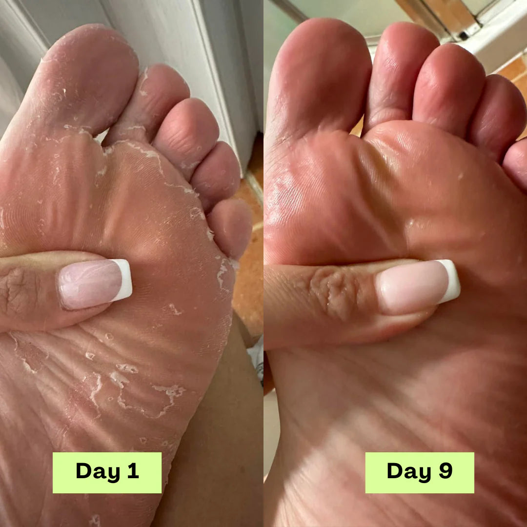Arivel Antifungal Soap