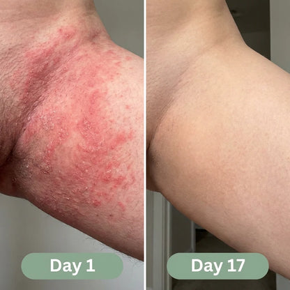 Arivel Antifungal Soap